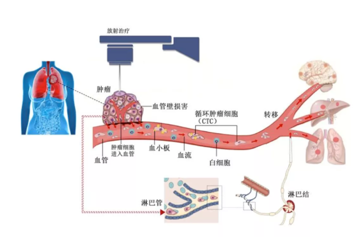 徐克成：癌症治疗的反思与探索