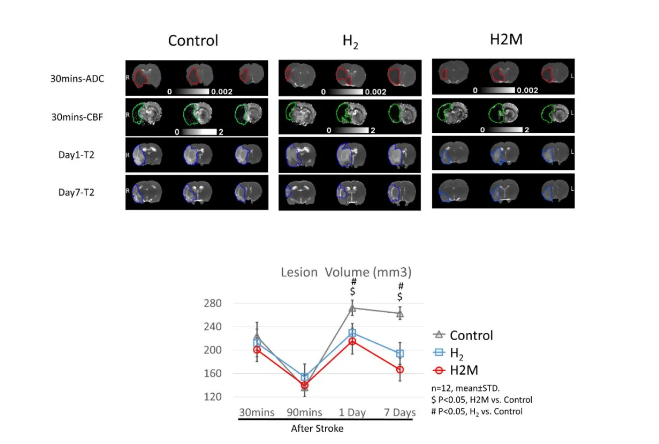 氢水治疗脑缺血新证据！
